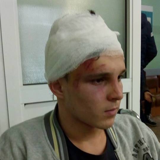 На Київщині п'ятеро школярів жорстоко побили сина чиновниці в новорічну ніч