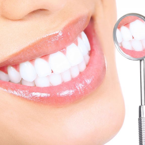 Супрун радить дотримуватися 5 правил, щоб зберегти здоров'я зубів