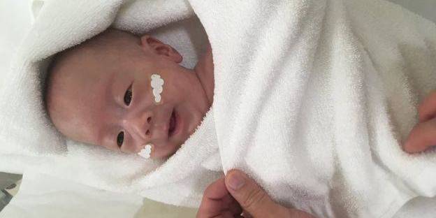В Японії врятували новонародженого хлопчика, який важив 268 грамів