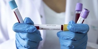 Наявність коронавірусу перевіряють у 4 українців