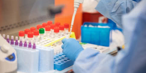 В Україні запустили виробництво ПЛР-тестів на коронавірус — ОП