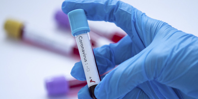 У МОЗ запевняють, що на коронавірус тестують усіх людей із симптомами